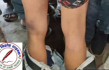 पुलिस की दादागिरी से व्यापारियों में रोष ! SO ने दो दुकानदारों को लाठी-डंडों से पीटा, व्यापार मंडल SP से करेगा मुलाकात !