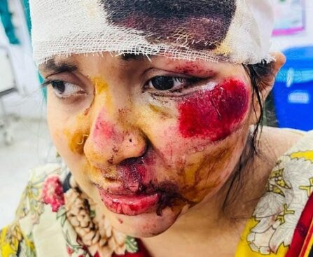 ठाकुरगंज में महिला से लूट, मारपीट और बच्ची के अपहरण की कोशिश, पुलिस बनी मूकदर्शक !