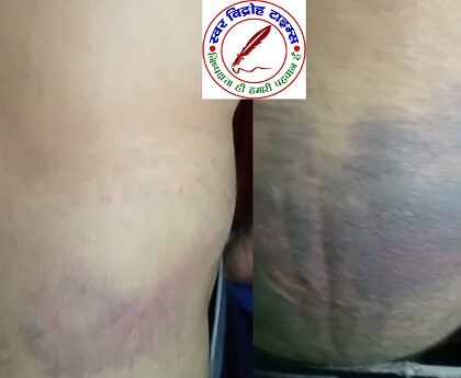 पत्रकार पुरम चौकी पर तैनात दरोगा मनीष मिश्रा के द्वारा चमड़ी उधेड़ने का एक और प्रकरण आया सामने !