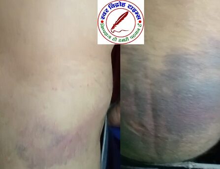 पत्रकार पुरम चौकी पर तैनात दरोगा मनीष मिश्रा के द्वारा चमड़ी उधेड़ने का एक और प्रकरण आया सामने !