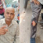 मोबाइल विस्फोट होने से कर्मचारी घायल !