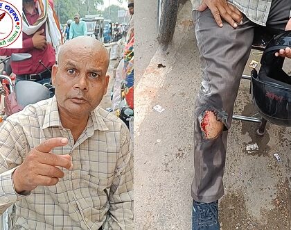 मोबाइल विस्फोट होने से कर्मचारी घायल !