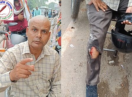 मोबाइल विस्फोट होने से कर्मचारी घायल !