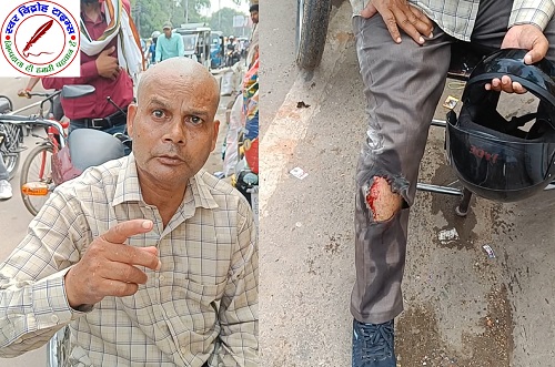 मोबाइल विस्फोट होने से कर्मचारी घायल !