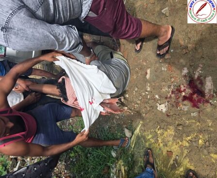 गंभीर हालत जिंदगी मौत से लड़ रहा जुबेर अहमद !